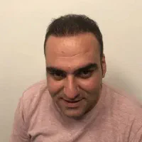 آفر ویژه کاشت مو و ابرو|خدمات آرایشگری و زیبایی|تهران, دبستان|دیوار