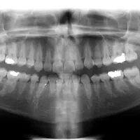 پذیرش ،مشاور ایمپلنت،دستیار تخصصی جراحی و ارتودنسی
