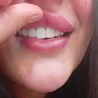 خدمات ویژه کامپوزیت ودندنسازی باقیمت ویژه|خدمات آرایشگری و زیبایی|یاسوج, |دیوار