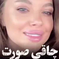 چاقی صورت|آرایشی، بهداشتی، درمانی|اهواز, کیان اباد|دیوار
