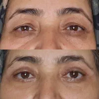 خدمات زیبایی تخصصی با قیمت‌های استثنایی|خدمات آرایشگری و زیبایی|مشهد, راهنمایی|دیوار