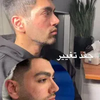 ساکشن غبغب/شکم پهلو/۳۶۰درجه/با دستگاه پال|خدمات آرایشگری و زیبایی|اسلام‌شهر, شهرک مفیدی|دیوار