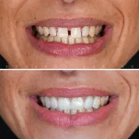 تخفیف خدمات دندانپزشکی و شرایط پرداخت اقساط|خدمات آرایشگری و زیبایی|رشت, گلسار|دیوار