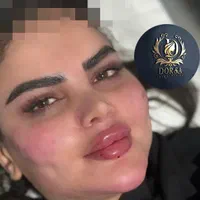 تزریق تخصصی ژل ومادلینگ خلیجی واروپایی وبوتاکس|خدمات آرایشگری و زیبایی|کرمانشاه, |دیوار