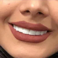 دندانپزشکی،روکش عصب کشی ،کامپوزیت