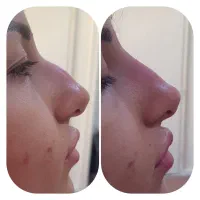 کلینیک تخصصی زیبایی دکتر فولادی|خدمات آرایشگری و زیبایی|دوگنبدان, |دیوار