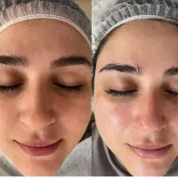 آف ویژه فیشال تخصصی فقط یک هفته