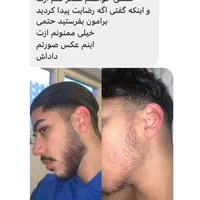 مشاوره ریزش مو و رویش مجدد|خدمات آرایشگری و زیبایی|مشهد, کلاهدوز|دیوار