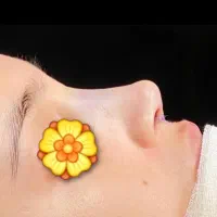 جراحی بینی،رینوپلاستی|خدمات زیبایی و سلامت|تهران, جهاد|دیوار