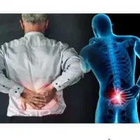 پماد ضد درد قوی سیاتیک زانو درد ارتروز