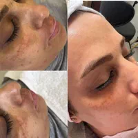 پیراپزشک طب سنتی متخصص پوست|خدمات آرایشگری و زیبایی|رشت, رودباری|دیوار