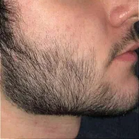 دیگه نگران کم پشتی ریش و سبیلت نباش