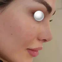 جراحی بینی (سپتورینوپلاستی) ولیعصر تهران