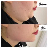 کلینیک تخصصی پوست و مو|خدمات آرایشگری و زیبایی|اهواز, پردیس|دیوار