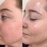 مدل فیشیال ویژه با یکبار فیشیال تغییر رااحساس کنید|خدمات آرایشگری و زیبایی|کرج, گلشهر|دیوار