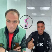 کاشت مو فول تراکم تضمینی