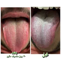 محصولات گیاهی|آرایشی، بهداشتی، درمانی|کرمانشاه, |دیوار