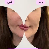 پنکک ۳کاره فول کاور