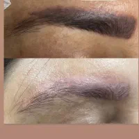 ریموو تخصصی درتربت جام|خدمات آرایشگری و زیبایی|تربت جام, والفجر|دیوار