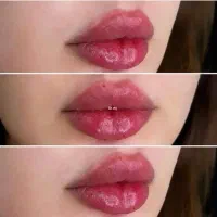ژل لب تخفیف ویژه بوتاکس چشم گربه ای فول فیس میدفیس