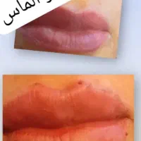 آف پنجاه درصد ژل و بوتاکس با بهترین برند|خدمات آرایشگری و زیبایی|اهواز, شریعتی جنوبی|دیوار