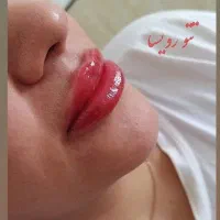 فیبروز/میکروبلیدینگ/تتو بدن/شیدینگ لب/سایه ابرو