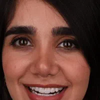 دندانپزشکی ،اوردنچر ، دندان مصنوعی ،ایمپلنت