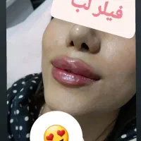 ژل ۹۵۰تومان فیلر بیکینی و باسن هر سی سی ۳۴۰