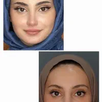 جراحی.بینی|خدمات آرایشگری و زیبایی|اراک, |دیوار