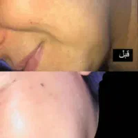 روشن کننده صورت و دست معجزه بشرط اصلی و گیاهی|آرایشی، بهداشتی، درمانی|یاسوج, |دیوار