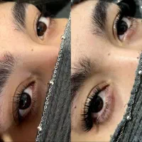 کاشت مژه
