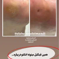 خدمات پودولوژی و پدیکور درمانی ، تخلیه میخچه و ..|خدمات آرایشگری و زیبایی|تهران, فردوس|دیوار