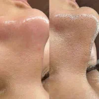 تخفیف خدمات آرایشی،میکرو،ناخن،تتو،فیشیال|خدمات آرایشگری و زیبایی|قرچک, امین آباد|دیوار