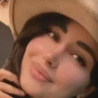 عمل بینی لیزری/بدون‌کبودی بدون‌ دردبیسودجراح معروف