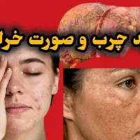 قاتل کبد چرب|آرایشی، بهداشتی، درمانی|تاکستان, |دیوار