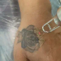 حذف تتو
