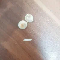 مهره با خواص