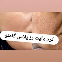 پک وایت رز پلاس|آرایشی، بهداشتی، درمانی|جهرم, |دیوار