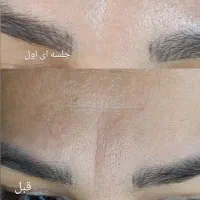 فیشال تخصصی پوست با بهترین متریال