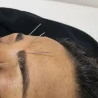 خدمات طب سوزنی و‌ماساژ درمانی