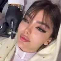 آموزش تزریق ژل وبوتاکس کلینیک  ،پی ارپی ، بایوفیلر