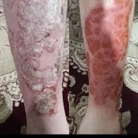 درمانگری طب سنتی وآموزش رایگان و مدرک