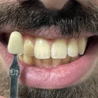 دندان پزشکی با بیمه تکمیلی و اقساطی