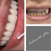 دندانسازی ناب نصف قیمت بازار|پزشکی|شیراز, حجت آباد|دیوار