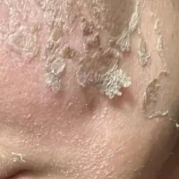 پاکسازی پوست،روشن شدن پوست ،لک  از ۴۵۰ هزار تومان