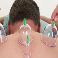 حجامت سنتی مراعات بهداشتی|خدمات آرایشگری و زیبایی|خاش, |دیوار