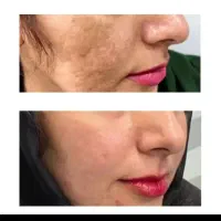 درمان پوست ومو