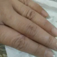 ضد چین وچروک ،شل شدگی وپیری پوست