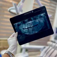 خدمات دندانپزشکی ترمیم و درمان ریشه، زیبایی،اطفال|خدمات آرایشگری و زیبایی|شهرکرد, |دیوار