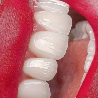 دستیار دندانپزشک